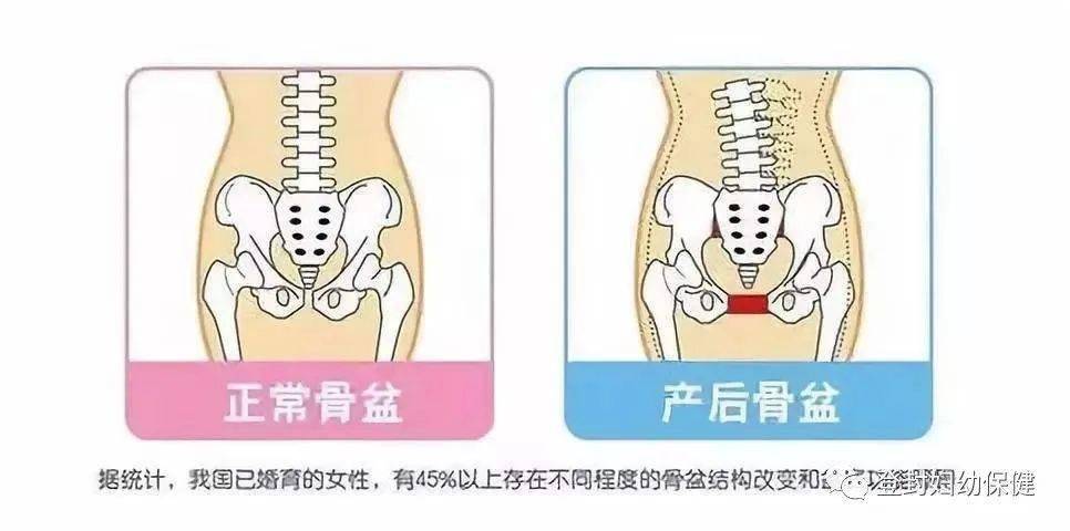 纤维环断裂：探讨修复可能性与恢复策略