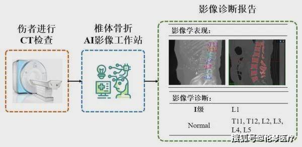 AI医学影像骨折分析报告：骨折描述与模板撰写指南