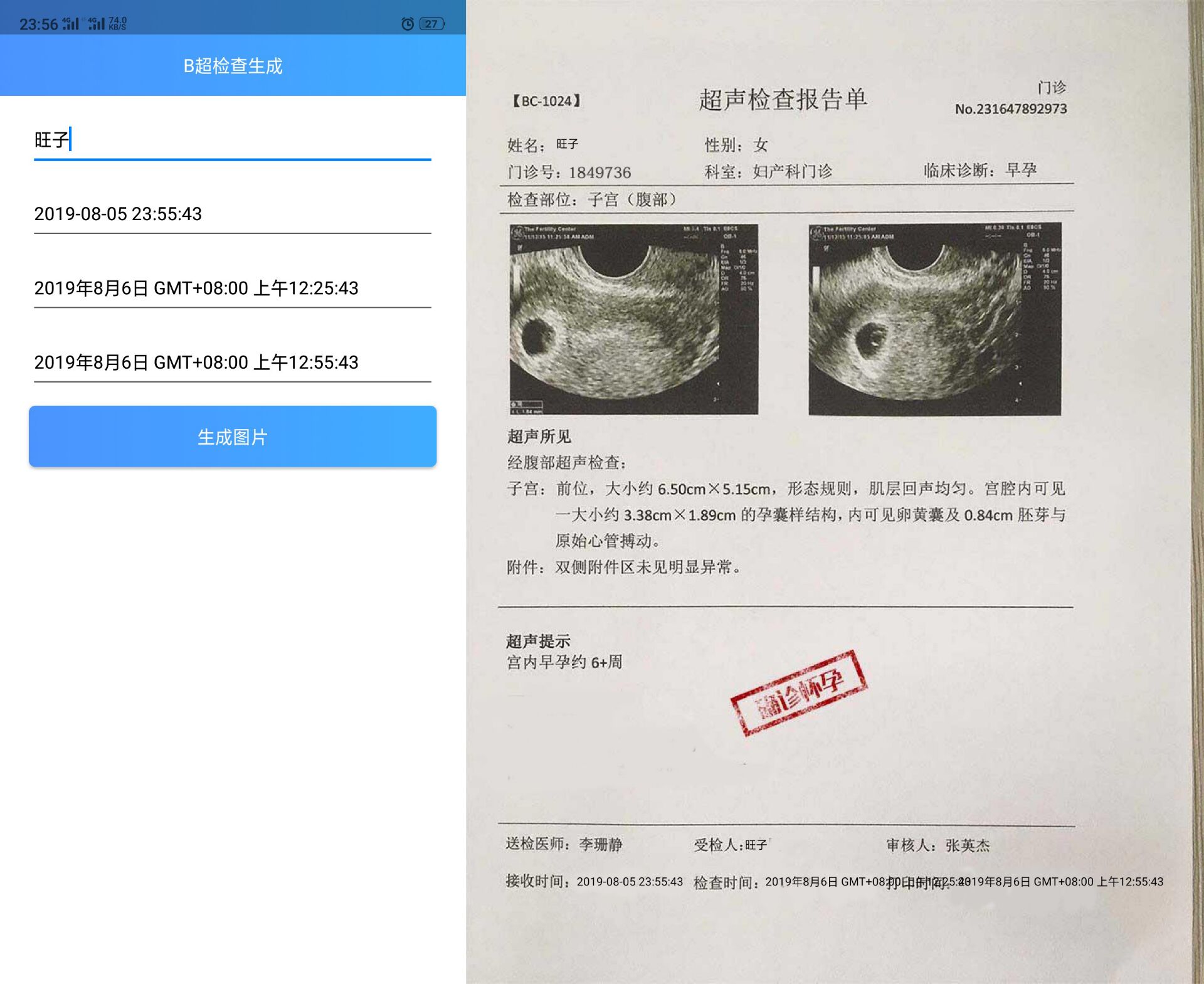 一键在线生成逼真怀孕报告单工具