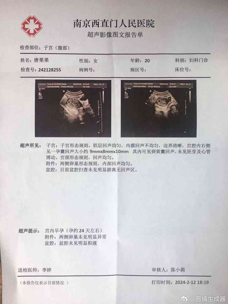 一键在线生成逼真怀孕报告单工具