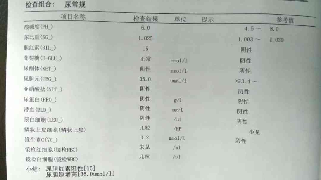 体检报告array：解读含义、多久出结果、性心律意义及三项指标查询方法