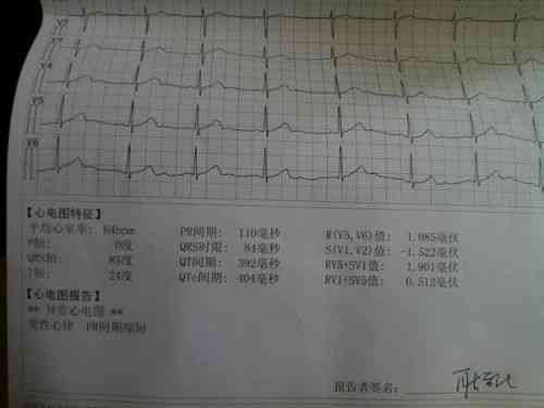 体检报告array：解读含义、多久出结果、性心律意义及三项指标查询方法