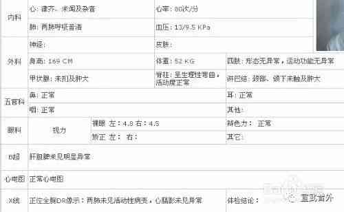 体检报告array：解读含义、多久出结果、性心律意义及三项指标查询方法