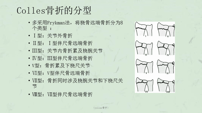 Colles骨折影像学报告：诊断描述与报告撰写