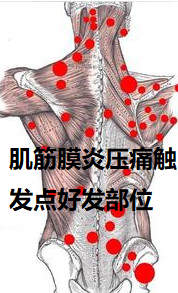 慢性肌筋膜炎：日常劳动能力受影响程度解析