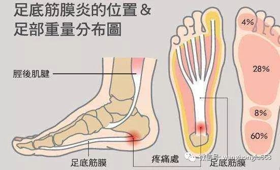 肌筋膜炎患者如何安排日常劳动与锻炼：避免损伤与促进复的全面指南