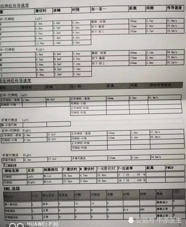 肌肉萎缩伤残等级鉴定：详解其伤残级别划分标准