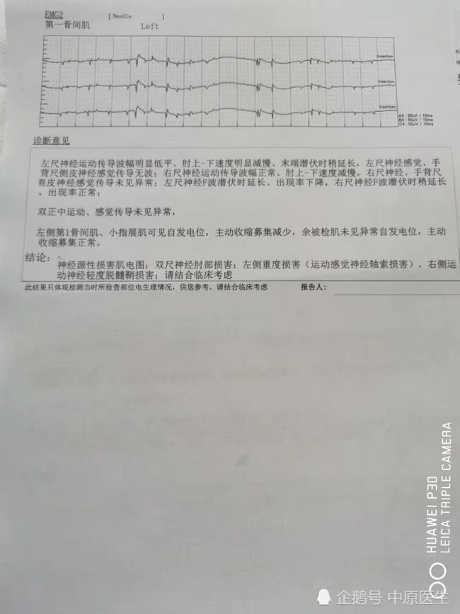 肌肉萎缩患者是否可申请伤残等级鉴定