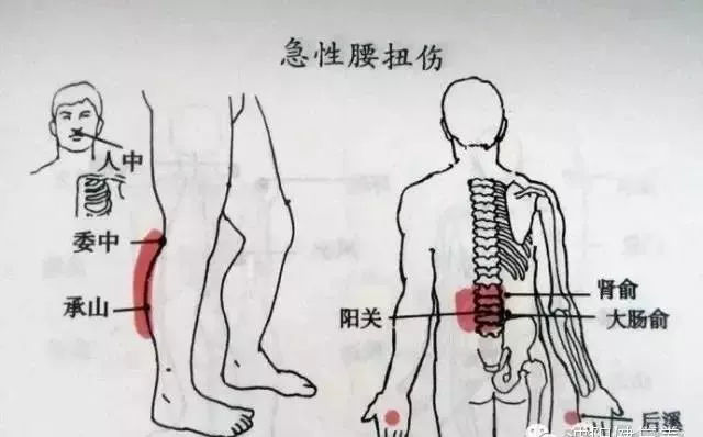 肌腱损伤工伤评定：更高可达到几级伤残等级？