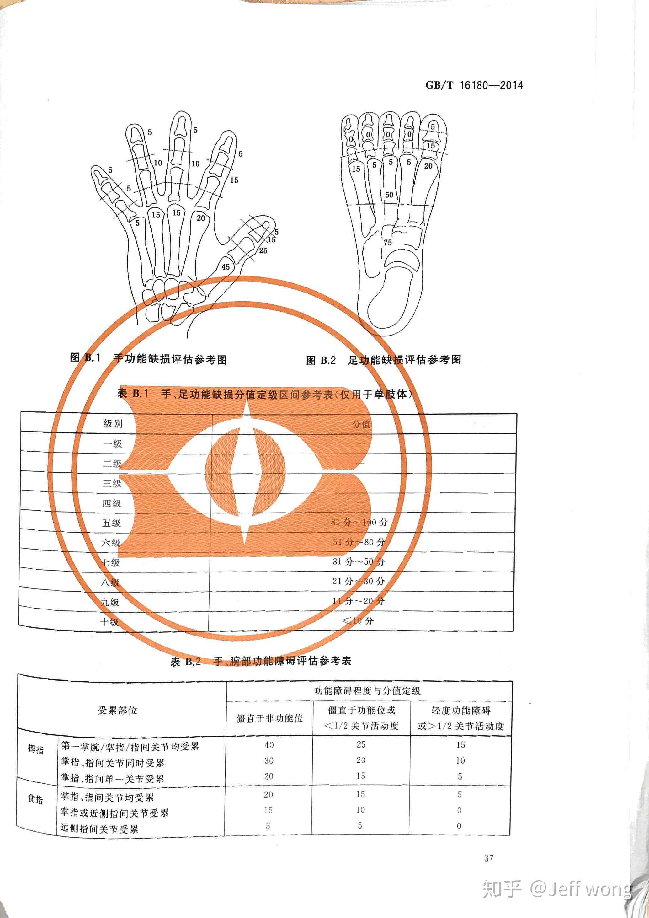 肌腱损伤如何评定伤残等级标准及条件