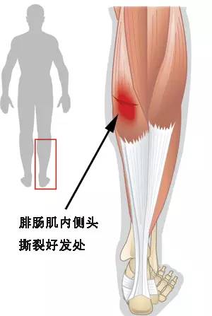 肌腱损伤更高评几级工伤及伤残等级判定标准