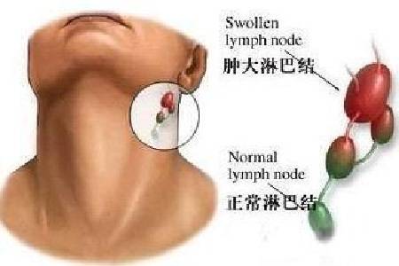 '肌腱损伤评定伤残等级的可能性与标准分析'