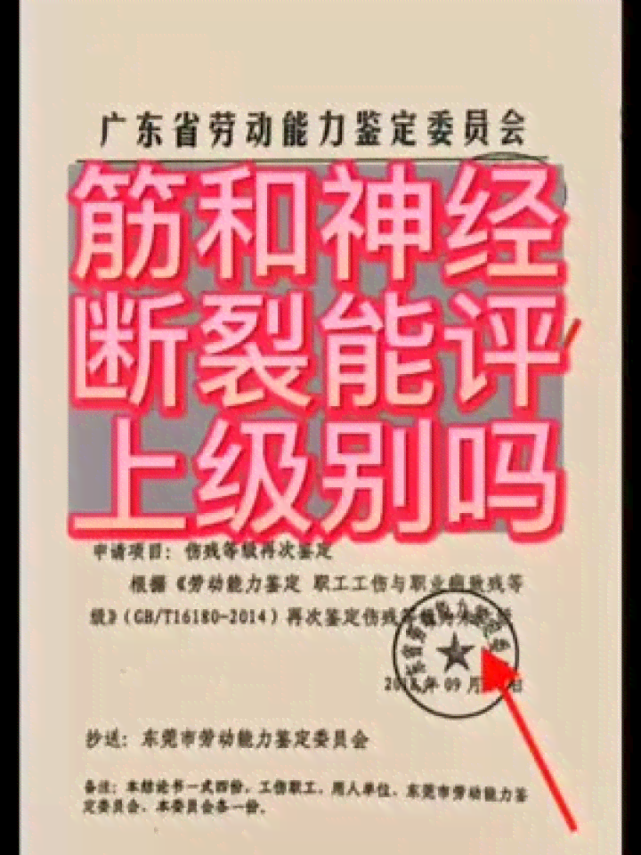 工伤肌腱断裂如何进行伤残等级评定与认定