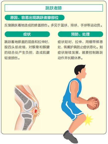 肌腱炎工伤认定指南：工作相关肌腱损伤的工伤等级与赔偿标准解析