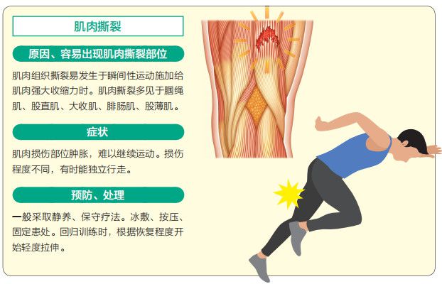 肌腱炎工伤认定指南：工作相关肌腱损伤的工伤等级与赔偿标准解析