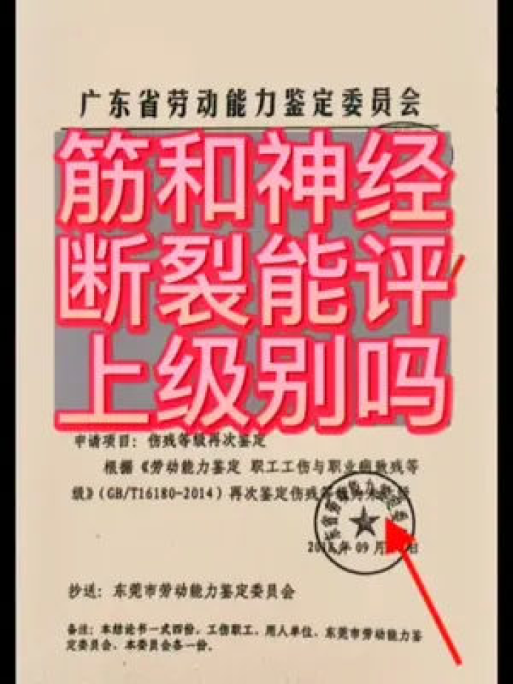 肌腱锻炼认定工伤为几级：肌腱损伤工伤级别标准及更高评定等级