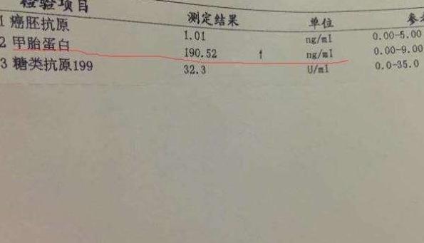 肛瘘病例：工伤认定标准与肛瘘病症关联解析