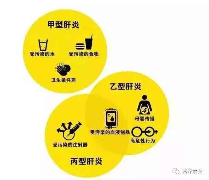 肝炎算不算职业病：肝病是否包含在职业病范围内？