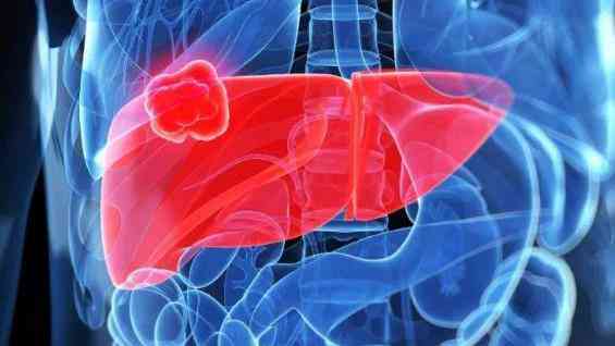 肝血肿多久能吸收：涵肝内及肝脏血肿吸收时间与恢复周期