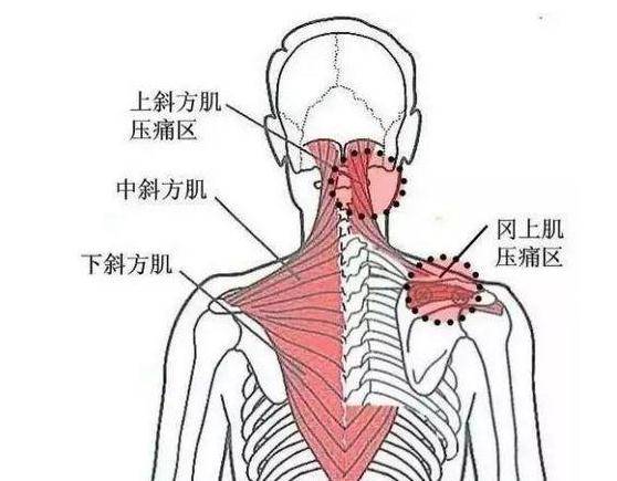 肩关节积液是否属于轻微损伤范畴解析