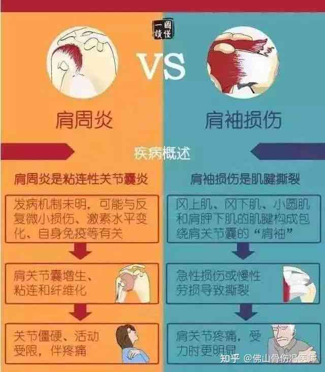 肩袖劳损可以认定工伤吗