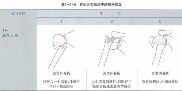 肱骨大结节能认定工伤吗：工伤赔偿金额及骨折伤残鉴定级别解析