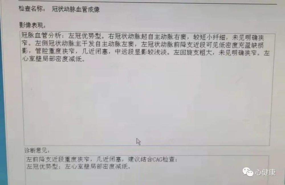 肺癌患者病退申请全解析：早期肺癌能否办理病退及所需条件流程