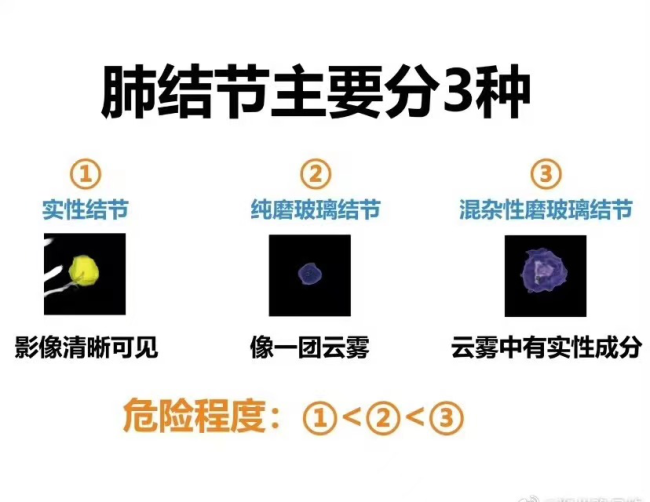 探讨肺结节是否被认定为工伤及职业病的新标准