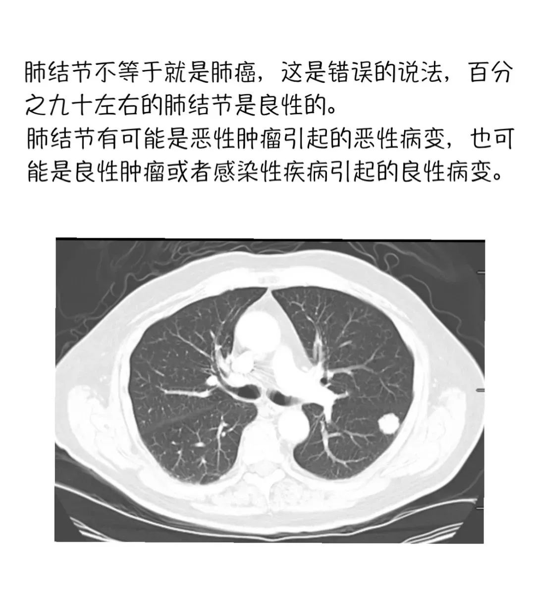 探讨肺结节是否被认定为工伤及职业病的新标准