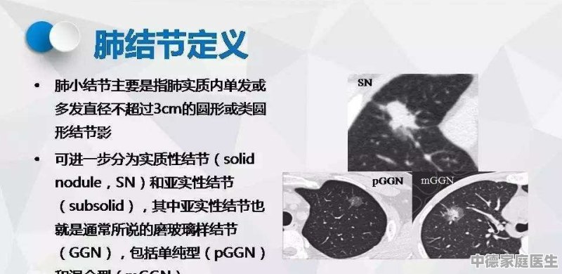 探讨肺结节是否被认定为工伤及职业病的新标准