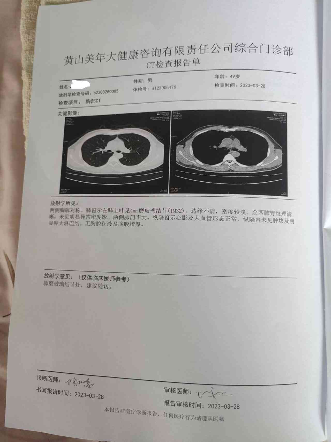 工伤鉴定：肺部结节是否合工伤申请条件