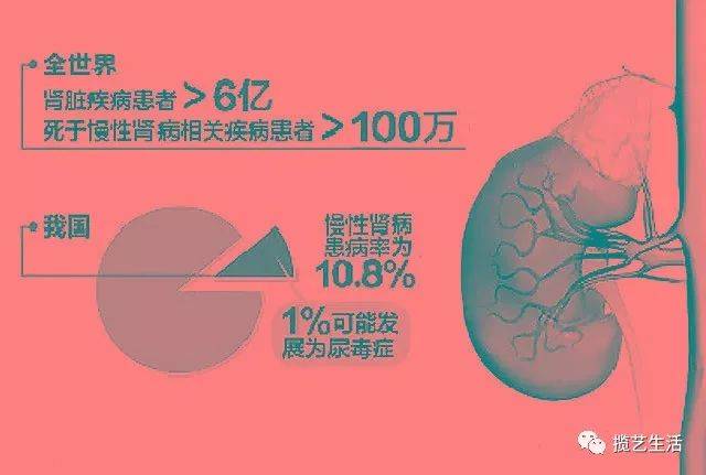 肾小球肾炎算不算大病：其在医保范围及肾病严重性分析