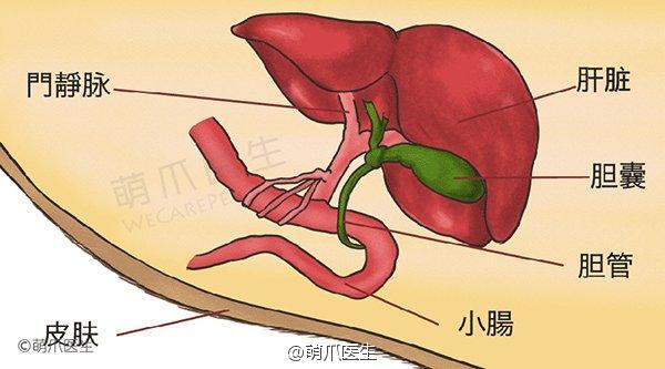 胆囊切除可以认定工伤吗