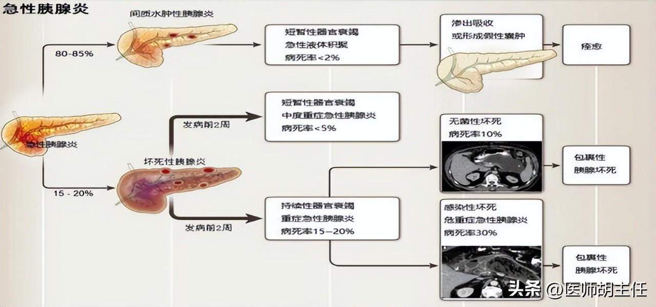 胰腺炎可以认定工伤吗