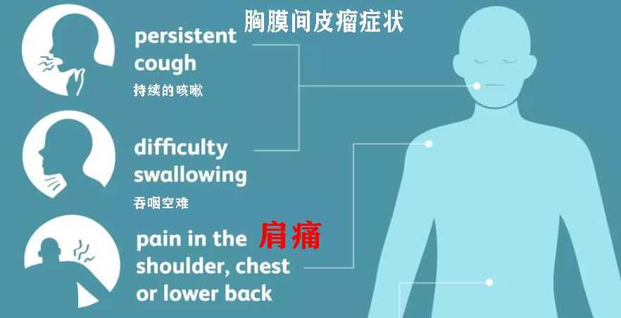 胸膜间皮瘤属于大病吗，严重程度如何，能否治愈及生存期展望