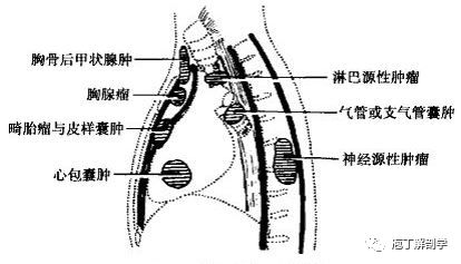 胸骨外伤疼痛症状解析及紧急处理指南