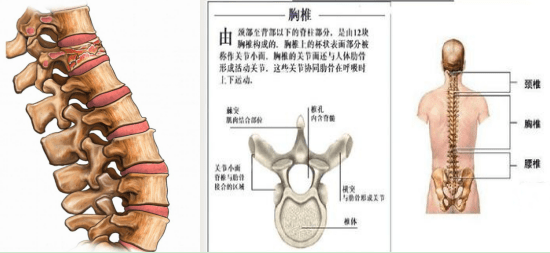 脊柱压缩性骨折工伤认定及赔偿标准详解