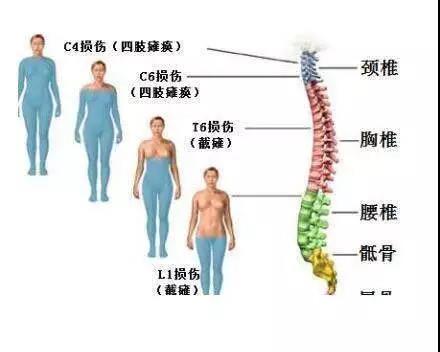 脊柱压缩性骨折：恢复过程、治疗选择与时间线解析