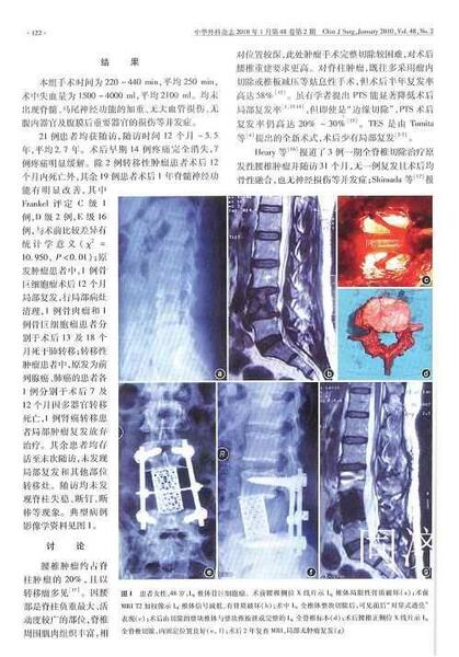 脊柱肿瘤切除手术：探讨治疗可能性与手术方案