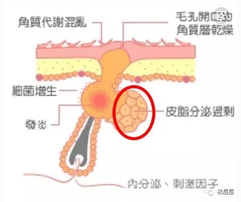 脊椎细菌感染能恢复吗：男女性治疗及注意事项，常用推荐