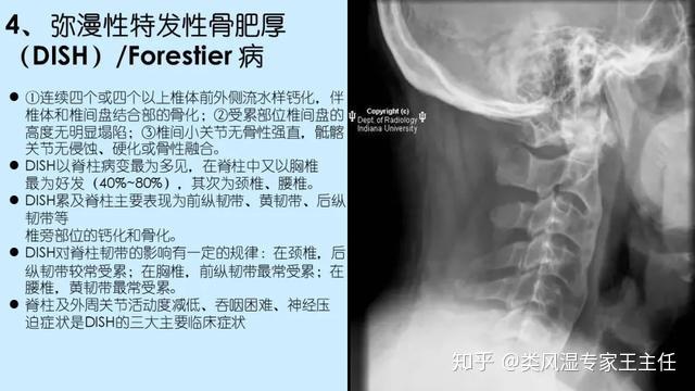 脊椎细菌感染能恢复吗：男女性治疗及注意事项，常用推荐