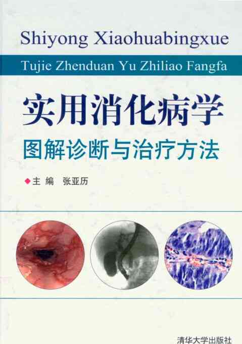 细菌性脊柱炎：症状、诊断与全面治疗方案解析