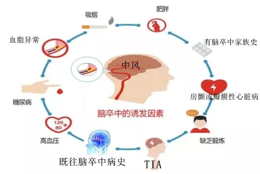 '脑卒中：它是否被归类为重大疾病的关键解析'