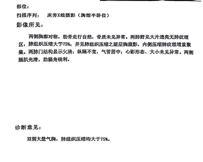 脑卒中患者是否合病退条件及如何申请病退待遇详解