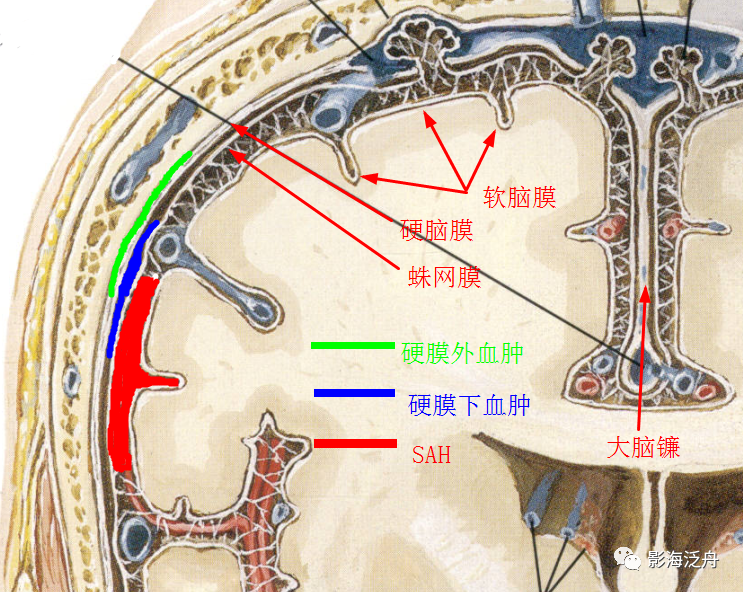 脑干出血属于职业病吗-脑干出血属于职业病吗可以做司法鉴定