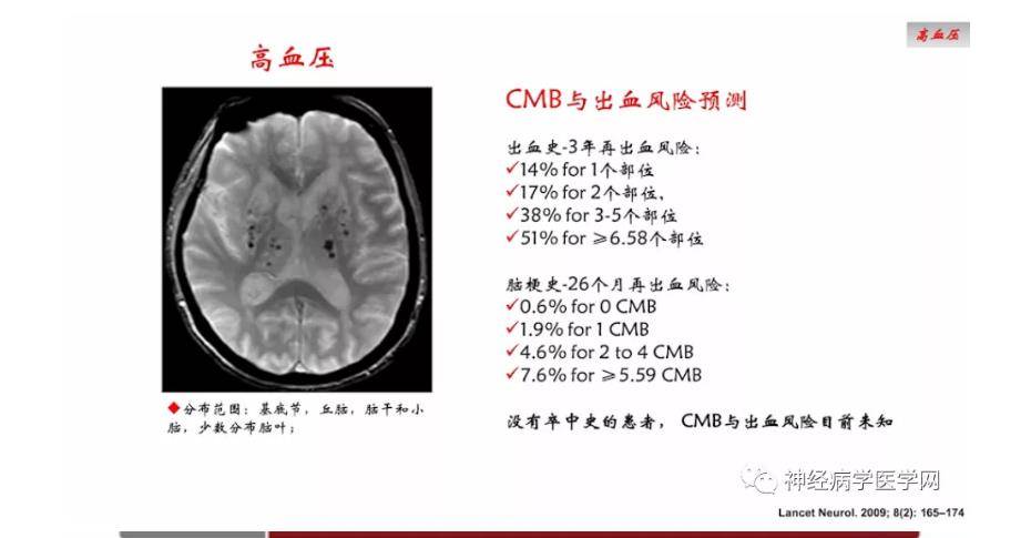 脑干出血属于职业病吗-脑干出血属于职业病吗可以做司法鉴定