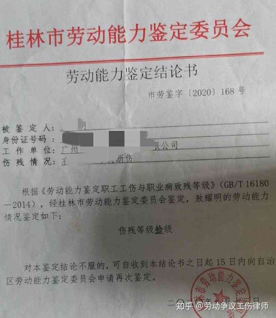 腮腺炎可认定工伤等级吗