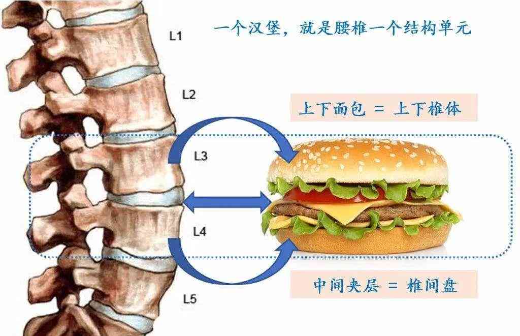 腰椎突出可以认定工伤嘛