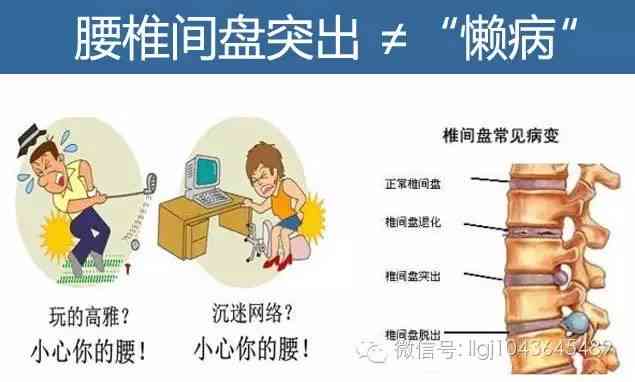 腰肌劳损可以认定工伤吗