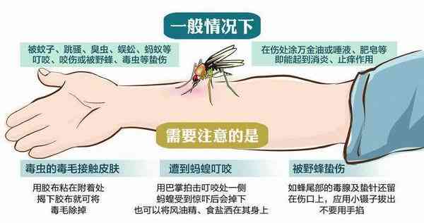 蚊虫叮咬能否认定工伤等级